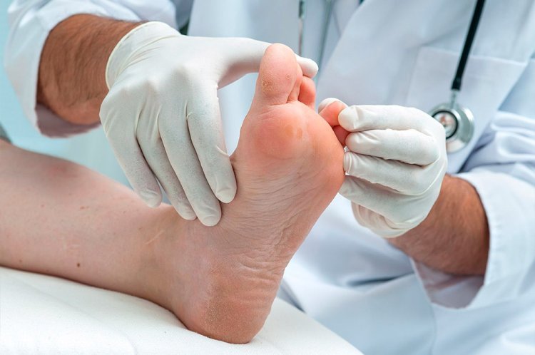 Diabetic Footcare in Edinburgh – Walk Comfortably Again